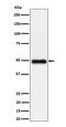 Reticulon 4 Receptor Like 1 antibody, M12234, Boster Biological Technology, Western Blot image 