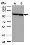 Eukaryotic Translation Elongation Factor 2 antibody, GTX102287, GeneTex, Western Blot image 