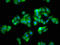 Heat Shock Protein Family A (Hsp70) Member 5 antibody, LS-C211271, Lifespan Biosciences, Immunofluorescence image 