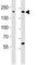 ERBB2 antibody, F52834-0.4ML, NSJ Bioreagents, Western Blot image 