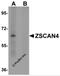 Zinc Finger And SCAN Domain Containing 4 antibody, 5611, ProSci, Western Blot image 