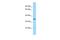 Spermatogenesis-associated serine-rich protein 1 antibody, A17304, Boster Biological Technology, Western Blot image 