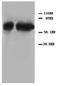 Tumor Protein P73 antibody, PA1064, Boster Biological Technology, Western Blot image 