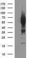 Tyrosine Hydroxylase antibody, CF506543, Origene, Western Blot image 