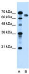 Nuclear Receptor Subfamily 5 Group A Member 2 antibody, TA343425, Origene, Western Blot image 