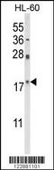 Peptidylprolyl Cis/Trans Isomerase, NIMA-Interacting 1 antibody, MBS9213484, MyBioSource, Western Blot image 