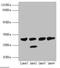 Proteasome Activator Subunit 1 antibody, LS-C676323, Lifespan Biosciences, Western Blot image 