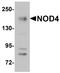 NLR Family CARD Domain Containing 5 antibody, A04481, Boster Biological Technology, Western Blot image 