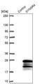 Synaptogyrin 4 antibody, PA5-63698, Invitrogen Antibodies, Western Blot image 