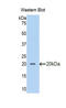 Secretory Leukocyte Peptidase Inhibitor antibody, LS-C298894, Lifespan Biosciences, Western Blot image 