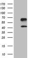 Hepatitis A Virus Cellular Receptor 2 antibody, TA807034S, Origene, Western Blot image 