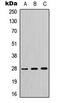 Tyrosine 3-Monooxygenase/Tryptophan 5-Monooxygenase Activation Protein Theta antibody, MBS8206470, MyBioSource, Western Blot image 