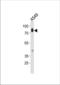 HCK Proto-Oncogene, Src Family Tyrosine Kinase antibody, TA324975, Origene, Western Blot image 
