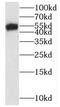 SWI/SNF Related, Matrix Associated, Actin Dependent Regulator Of Chromatin, Subfamily D, Member 2 antibody, FNab08012, FineTest, Western Blot image 