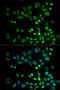 Proteasome 26S Subunit, Non-ATPase 10 antibody, 18-408, ProSci, Immunofluorescence image 