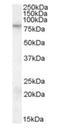 Fragile X Mental Retardation 1 antibody, orb19826, Biorbyt, Western Blot image 