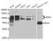 Enhancer Of Zeste 2 Polycomb Repressive Complex 2 Subunit antibody, STJ28310, St John