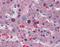 CUGBP Elav-Like Family Member 1 antibody, A02163-1, Boster Biological Technology, Immunohistochemistry paraffin image 