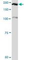 Plexin A2 antibody, H00005362-M06, Novus Biologicals, Western Blot image 