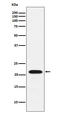 Core-Binding Factor Subunit Beta antibody, M01007-1, Boster Biological Technology, Western Blot image 