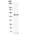 Gamma-Aminobutyric Acid Type A Receptor Beta3 Subunit antibody, R32046, NSJ Bioreagents, Western Blot image 