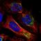 AXL Receptor Tyrosine Kinase antibody, NBP2-38345, Novus Biologicals, Immunocytochemistry image 