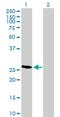 Regulator Of Calcineurin 2 antibody, H00010231-B01P, Novus Biologicals, Western Blot image 