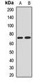 NEDD1 Gamma-Tubulin Ring Complex Targeting Factor antibody, LS-C668945, Lifespan Biosciences, Western Blot image 