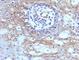 CD59 Molecule (CD59 Blood Group) antibody, V3022IHC-7ML, NSJ Bioreagents, Immunohistochemistry frozen image 