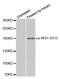 Insulin Receptor Substrate 1 antibody, MBS128521, MyBioSource, Western Blot image 