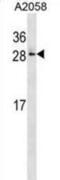 RAB28, Member RAS Oncogene Family antibody, abx029198, Abbexa, Western Blot image 