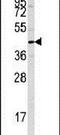 Protein Tyrosine Phosphatase Non-Receptor Type 7 antibody, PA5-14559, Invitrogen Antibodies, Western Blot image 