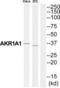 Aldo-Keto Reductase Family 1 Member A1 antibody, abx014163, Abbexa, Western Blot image 