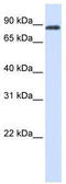 HECT Domain E3 Ubiquitin Protein Ligase 2 antibody, TA331541, Origene, Western Blot image 