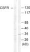 Colony Stimulating Factor 1 Receptor antibody, abx012809, Abbexa, Western Blot image 