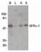 GDNF Family Receptor Alpha 1 antibody, PA5-19873, Invitrogen Antibodies, Western Blot image 