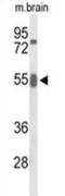 Growth Factor Receptor Bound Protein 7 antibody, abx034383, Abbexa, Western Blot image 