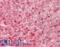 Alpha-1-antitrypsin antibody, LS-B12084, Lifespan Biosciences, Immunohistochemistry frozen image 