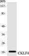 CKLF Like MARVEL Transmembrane Domain Containing 6 antibody, LS-C291804, Lifespan Biosciences, Western Blot image 