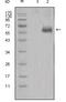 Dickkopf WNT Signaling Pathway Inhibitor 1 antibody, GTX83132, GeneTex, Western Blot image 