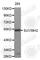 Suppressor Of Variegation 3-9 Homolog 2 antibody, A3227, ABclonal Technology, Western Blot image 