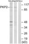Plakophilin 2 antibody, LS-C120222, Lifespan Biosciences, Western Blot image 