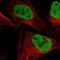 SWI/SNF Related, Matrix Associated, Actin Dependent Regulator Of Chromatin Subfamily C Member 2 antibody, PA5-54351, Invitrogen Antibodies, Immunofluorescence image 