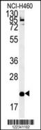 SLAM Family Member 7 antibody, 62-007, ProSci, Western Blot image 