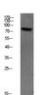 Spleen Associated Tyrosine Kinase antibody, STJ99593, St John