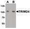 Tripartite Motif Containing 24 antibody, PA5-34561, Invitrogen Antibodies, Western Blot image 