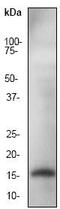 Actin Related Protein 2/3 Complex Subunit 5 antibody, ab51243, Abcam, Western Blot image 