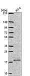 Ubiquitin Conjugating Enzyme E2 V1 antibody, NBP2-57183, Novus Biologicals, Western Blot image 
