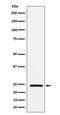 Superoxide Dismutase 2 antibody, M00349-2, Boster Biological Technology, Western Blot image 