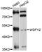 WD Repeat And FYVE Domain Containing 2 antibody, STJ112611, St John